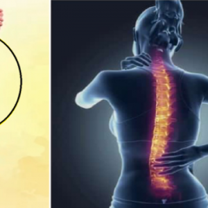 colonne vertébrale et femme souffrant des vertebres dorsales