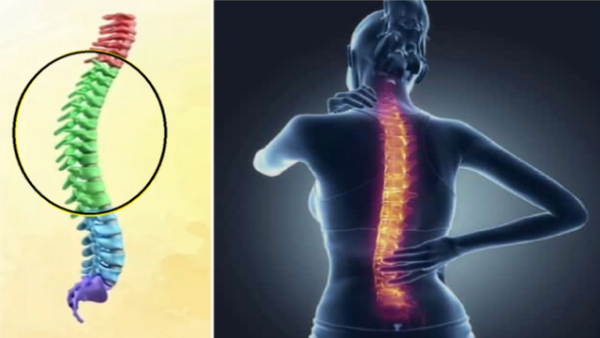 colonne vertébrale et femme souffrant des vertebres dorsales