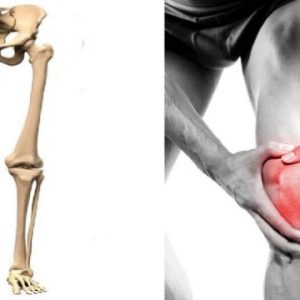 squelette et homme souffrant du genou