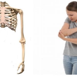 squelette et femme souffrant du coude