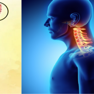 colonne vertébrale et homme souffrant des cevicales