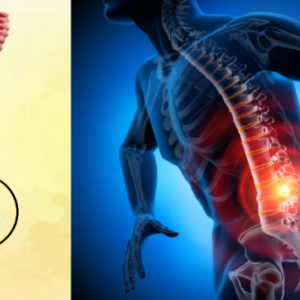 colonne vertébrale et homme souffrant des lombaires