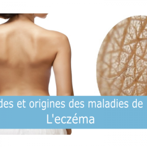 femme de dos avec gros plan sur la peau