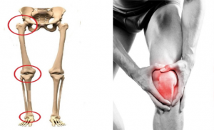 squelette et homme souffrant du genou